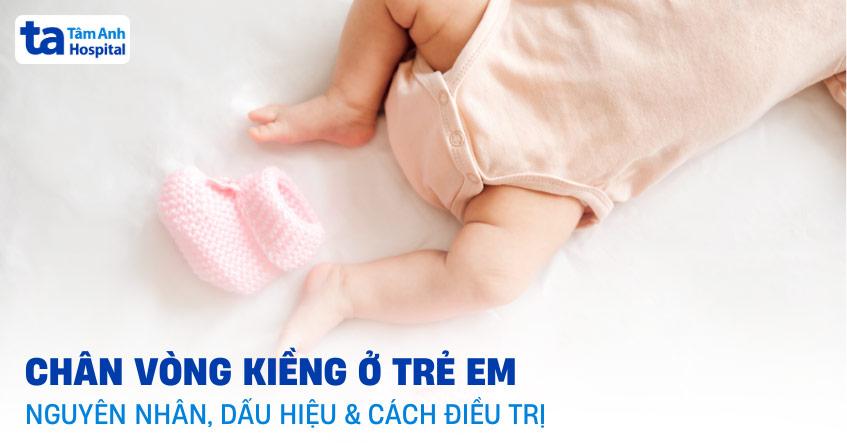 chân vòng kiềng ở trẻ em