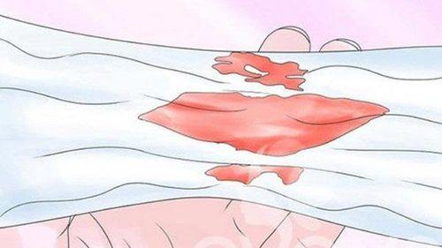 Dịch nhầy màu hồng là dấu hiệu chuyển dạ sớm của mẹ bầu trước khi sinh nở khoảng 1 tuần
